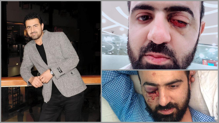 https://www.hindi.awazthevoice.in/upload/news/162593963722_Mustafa_before_(left)_and_after_attack_(right)_3.jpg