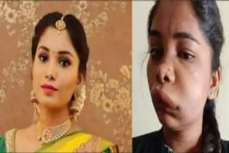 रूट कैनाल सर्जरी के बाद कन्नड़ अभिनेत्री स्वाति का चेहरा सूजा