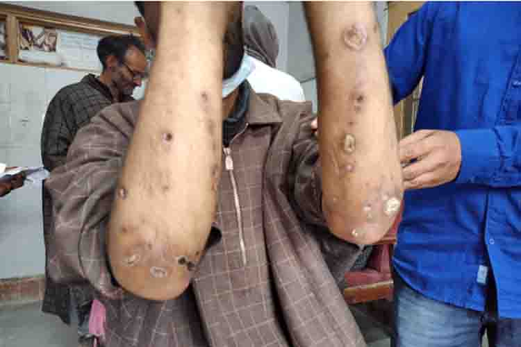 कश्मीर में नशामुक्तिः उम्मीदें अभी ख़त्म नहीं हुई हैं कश्मीर में नशामुक्तिः उम्मीदें अभी ख़त्म नहीं हुई हैं