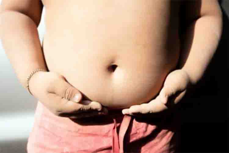 If there is severe obesity in childhood, then the lifespan will be reduced significantly