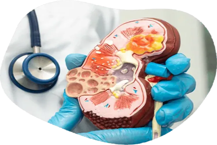 Homeopathy: A ray of hope in chronic kidney disease management
