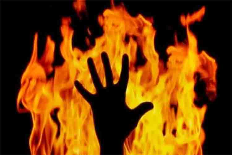 Another brutality with a woman in Pakistan, husband burnt his wife by pouring petrol on her