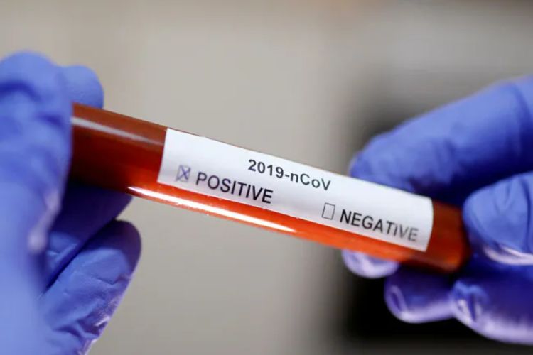 Decline in active COVID-19 cases in Assam, five more patients recover from the disease