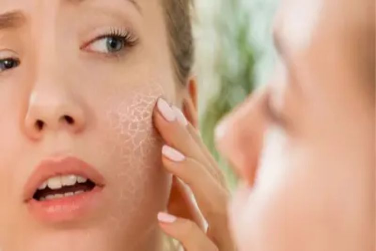 Are you troubled by dullness of skin? Then adopt these home remedies quickly