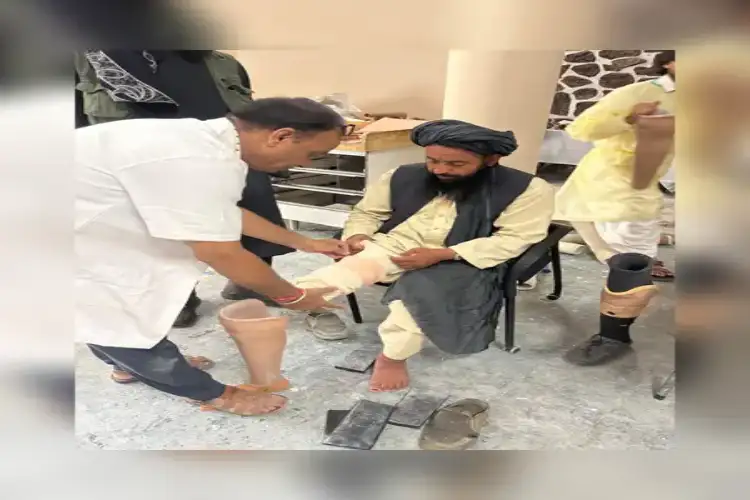 India provides prosthetic limbs to Afghans
