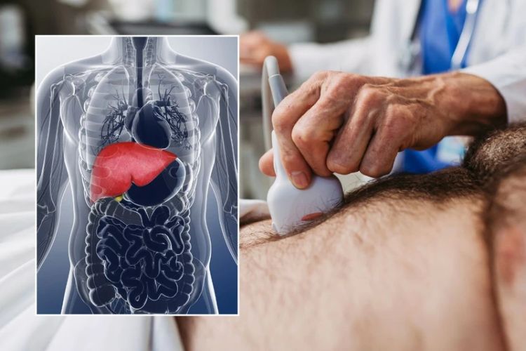 New drug offers hope of preventing fatty liver disease: Study