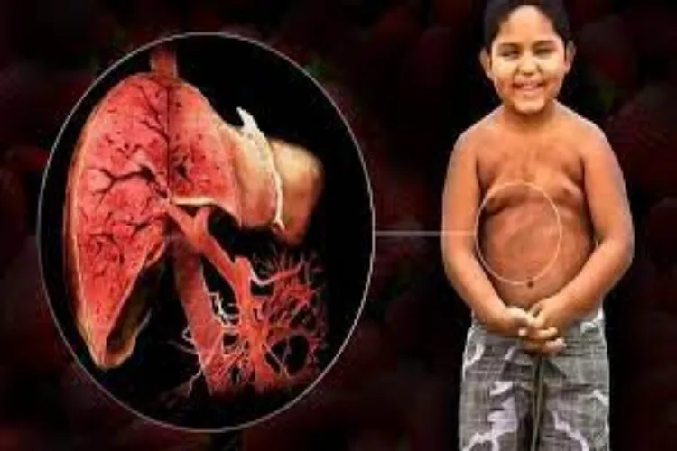 It's not obesity itself, but rather the amount of fat stored in the liver that determines health risks in children.
