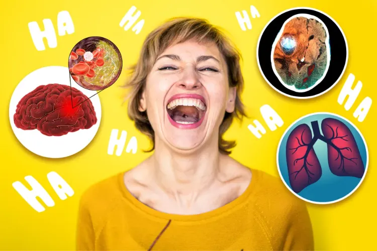 Can excessive laughter cause death? Scientists report a shocking finding.