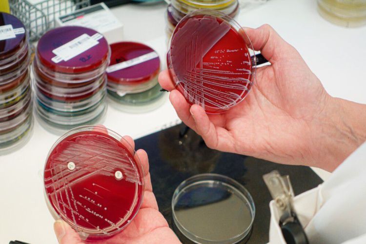 E. coli virus spreads incredibly fast, scientists make a major revelation.