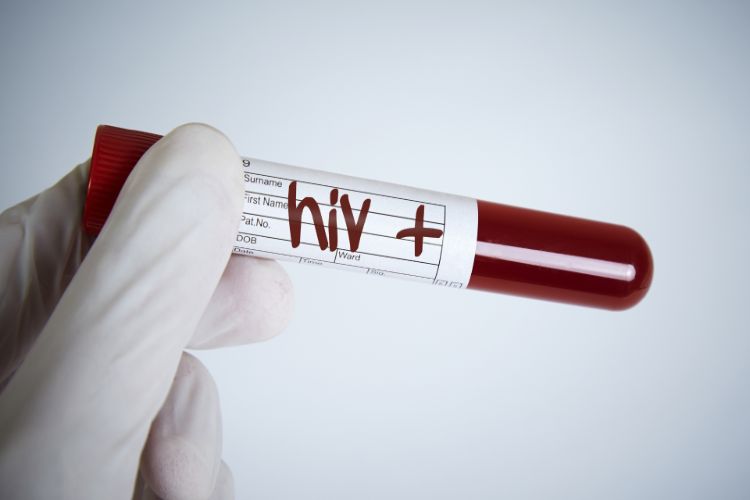HIV/AIDS cases crossing 10,000 in Meghalaya a matter of concern: Officials