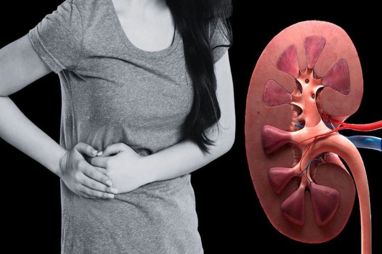 A new study suggests a common constipation medication may slow kidney failure.