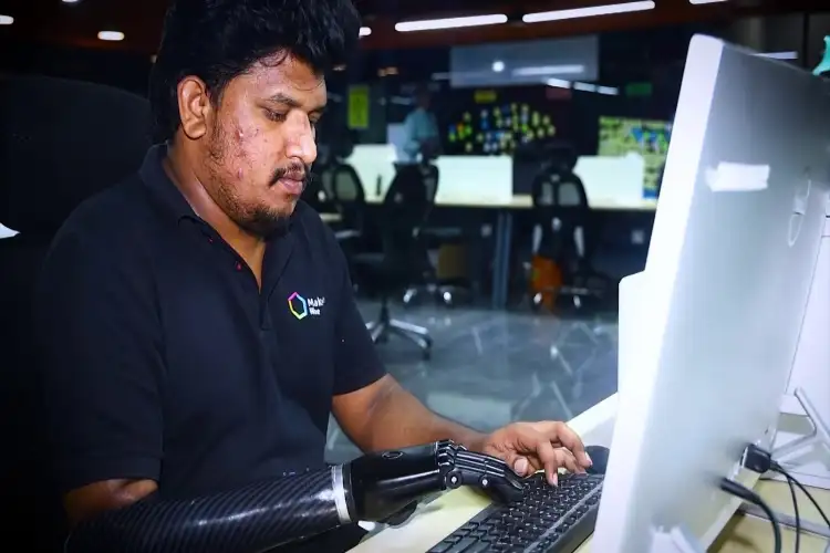 Hyderabad's bionic hands: Restoring lives, rebuilding confidence