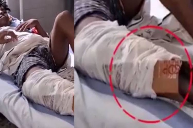 Bihar: Investigation launched into use of cardboard splint for fracture treatment at hospital