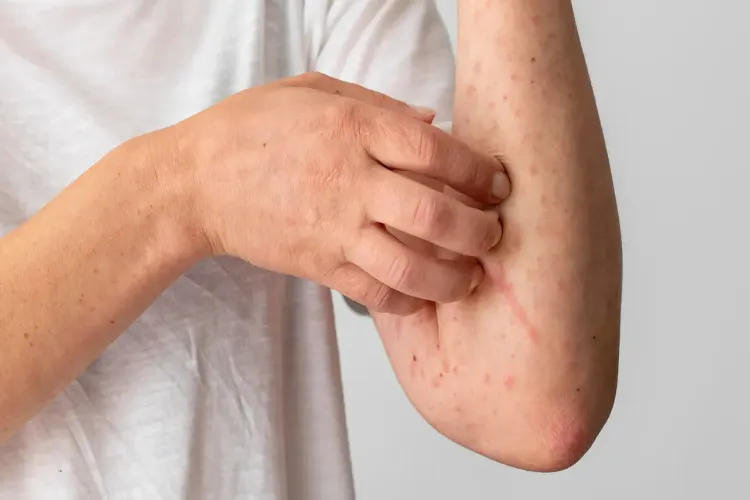 Why does skin itching worsen at night? Find out the reasons.