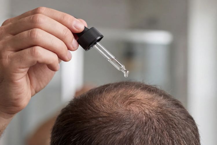 When does minoxidil cause hair growth? Learn the complete timeline.